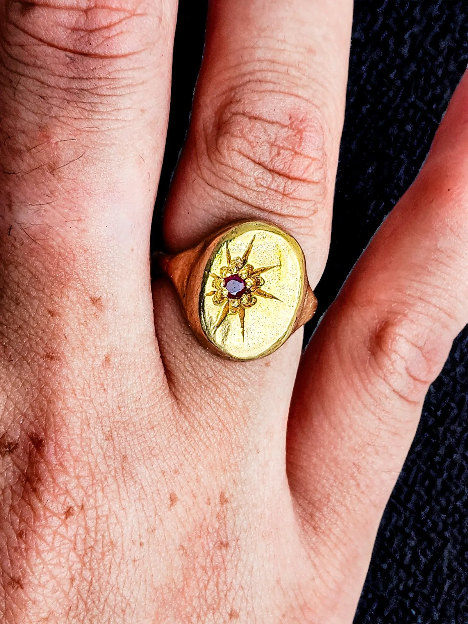 Starburst signet ring - Gold Ruby